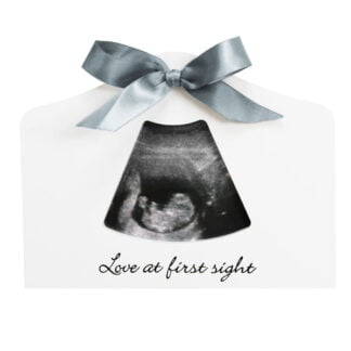 Moldura para Ecografia (Happy Hands Sonogram Echo Frame)