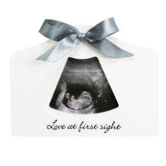 Moldura para Ecografia (Happy Hands Sonogram Echo Frame)